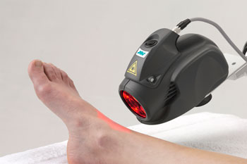 laser treatment