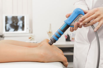 shockwave therapy